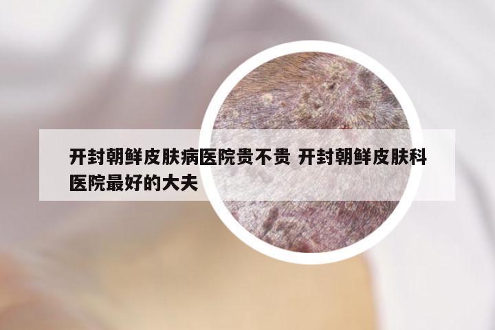 开封朝鲜皮肤病医院贵不贵 开封朝鲜皮肤科医院最好的大夫
