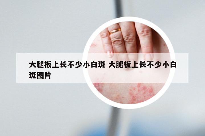 大腿板上长不少小白斑 大腿板上长不少小白斑图片