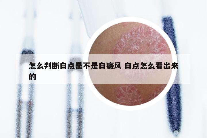怎么判断白点是不是白癜风 白点怎么看出来的