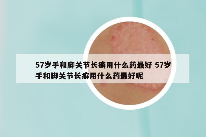 57岁手和脚关节长癣用什么药最好 57岁手和脚关节长癣用什么药最好呢