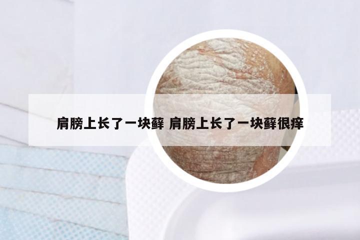 肩膀上长了一块藓 肩膀上长了一块藓很痒