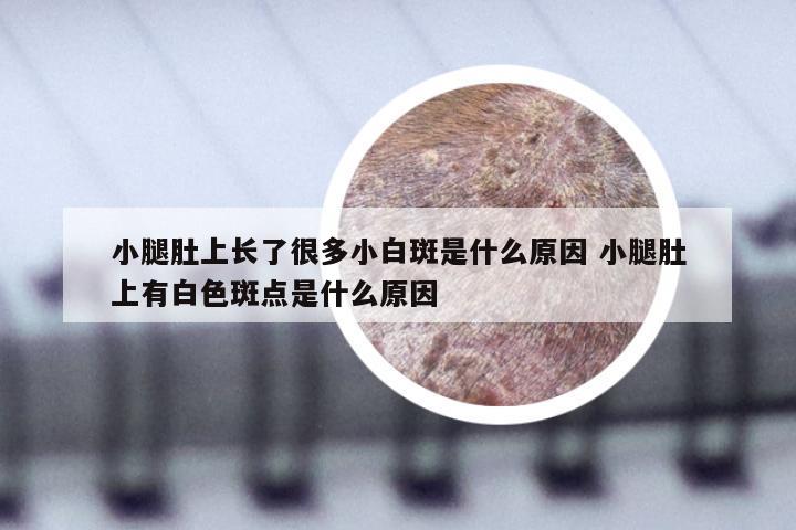 小腿肚上长了很多小白斑是什么原因 小腿肚上有白色斑点是什么原因