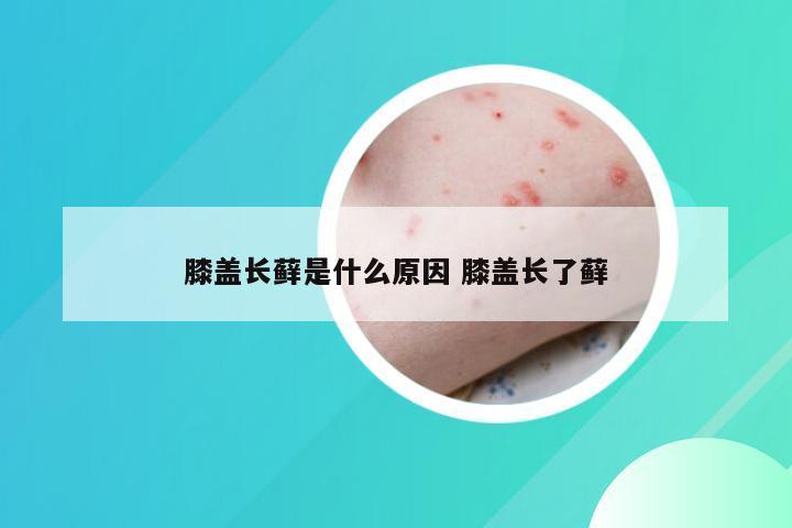 膝盖长藓是什么原因 膝盖长了藓