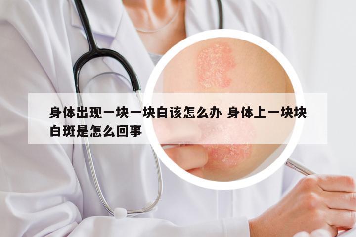身体出现一块一块白该怎么办 身体上一块块白斑是怎么回事