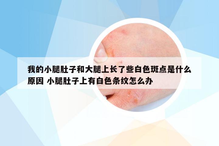 我的小腿肚子和大腿上长了些白色斑点是什么原因 小腿肚子上有白色条纹怎么办