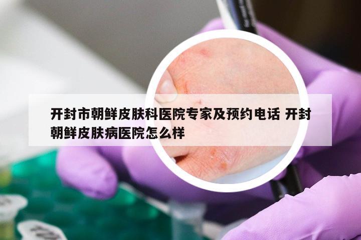 开封市朝鲜皮肤科医院专家及预约电话 开封朝鲜皮肤病医院怎么样