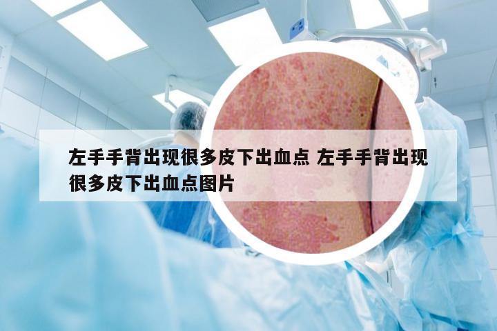 左手手背出现很多皮下出血点 左手手背出现很多皮下出血点图片