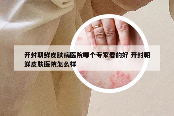 开封朝鲜皮肤病医院哪个专家看的好 开封朝鲜皮肤医院怎么样