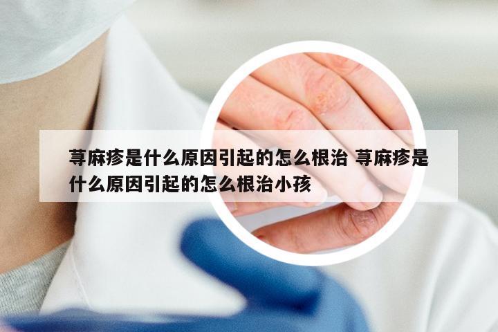 荨麻疹是什么原因引起的怎么根治 荨麻疹是什么原因引起的怎么根治小孩