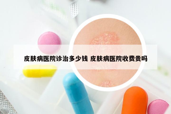 皮肤病医院诊治多少钱 皮肤病医院收费贵吗