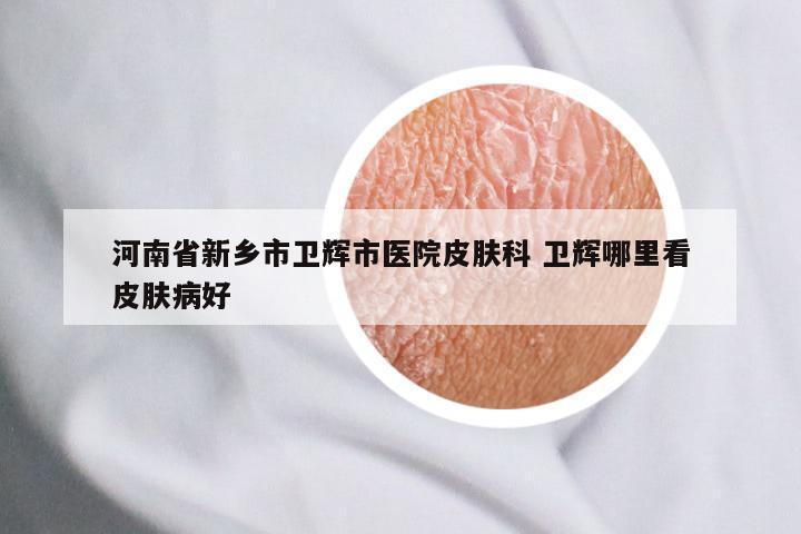 河南省新乡市卫辉市医院皮肤科 卫辉哪里看皮肤病好