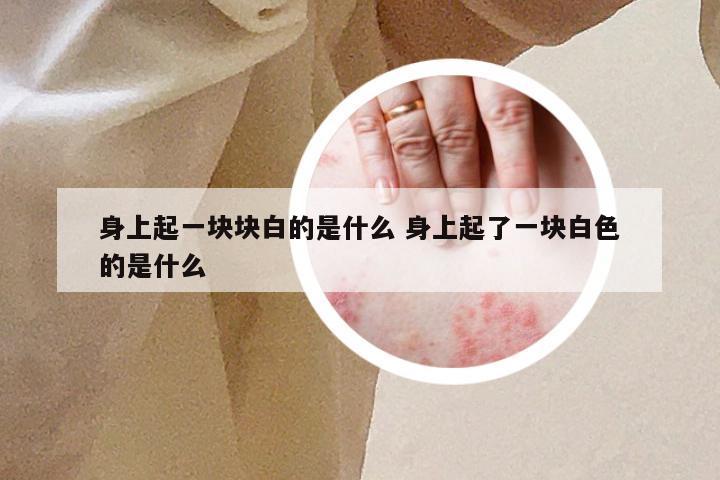 身上起一块块白的是什么 身上起了一块白色的是什么