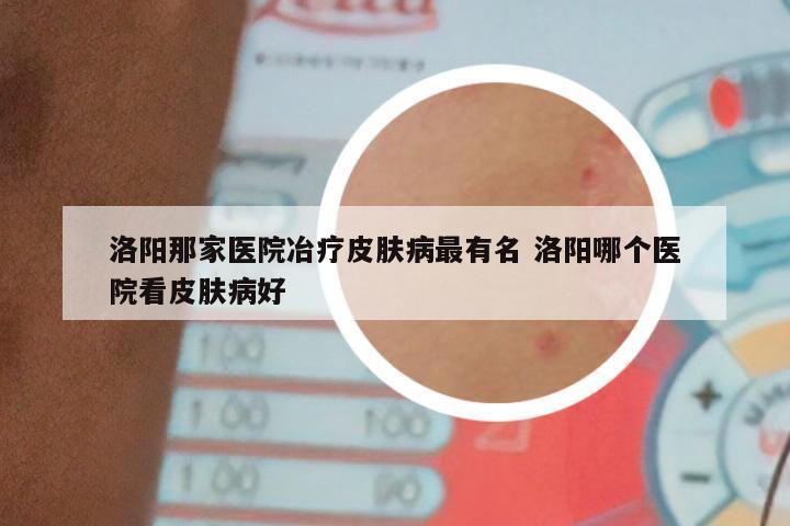 洛阳那家医院冶疗皮肤病最有名 洛阳哪个医院看皮肤病好