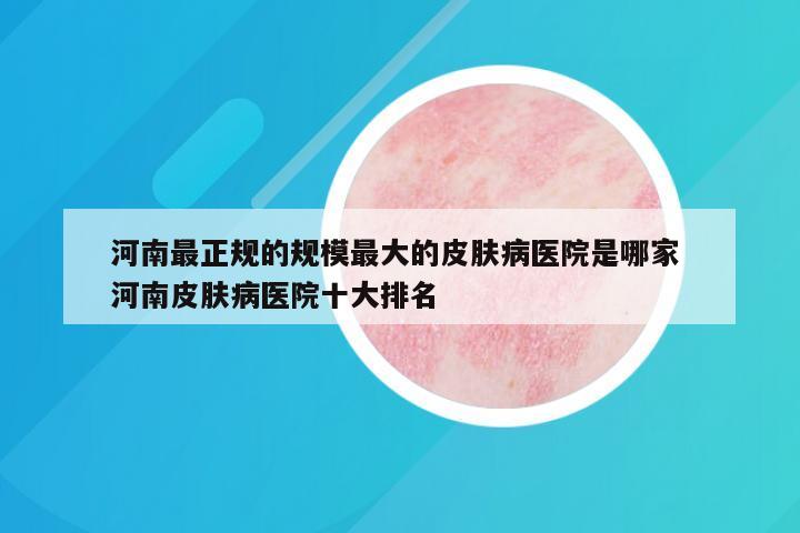 河南最正规的规模最大的皮肤病医院是哪家 河南皮肤病医院十大排名
