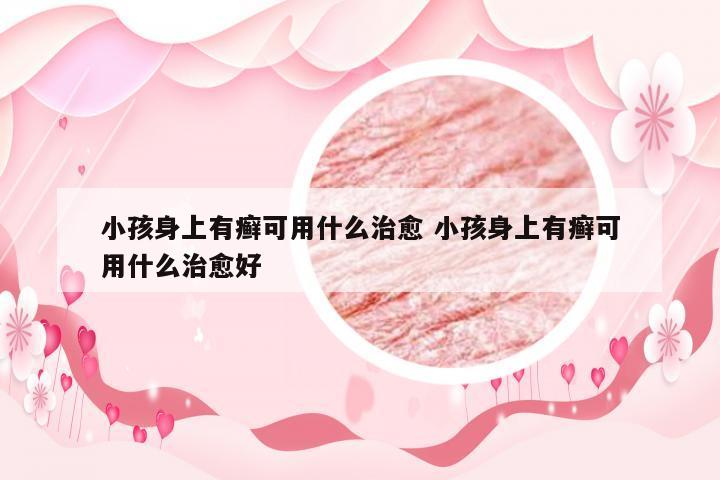 小孩身上有癣可用什么治愈 小孩身上有癣可用什么治愈好