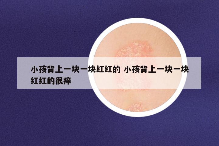 小孩背上一块一块红红的 小孩背上一块一块红红的很痒