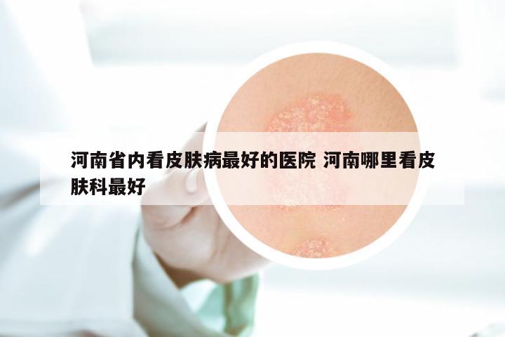 河南省内看皮肤病最好的医院 河南哪里看皮肤科最好