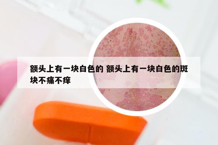额头上有一块白色的 额头上有一块白色的斑块不痛不痒
