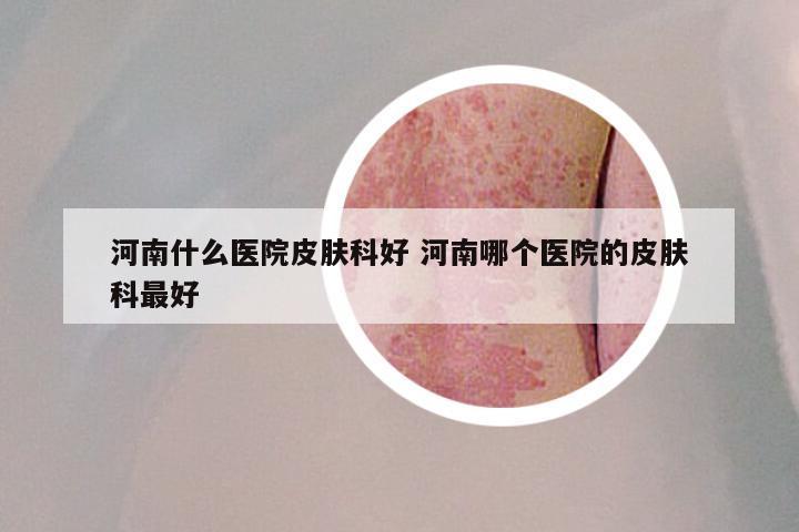 河南什么医院皮肤科好 河南哪个医院的皮肤科最好