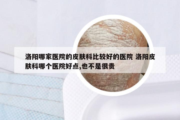 洛阳哪家医院的皮肤科比较好的医院 洛阳皮肤科哪个医院好点,也不是很贵