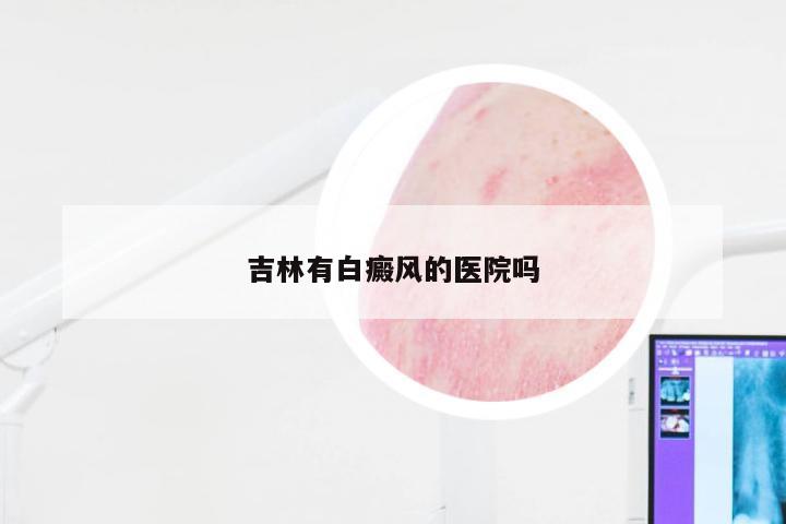 吉林有白癜风的医院吗