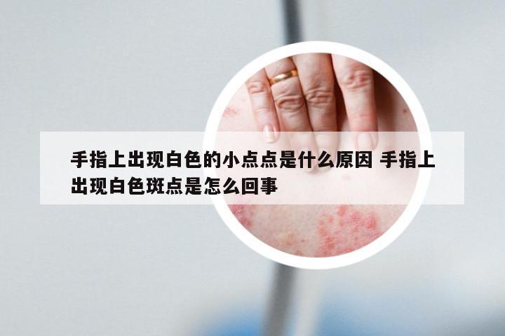 手指上出现白色的小点点是什么原因 手指上出现白色斑点是怎么回事