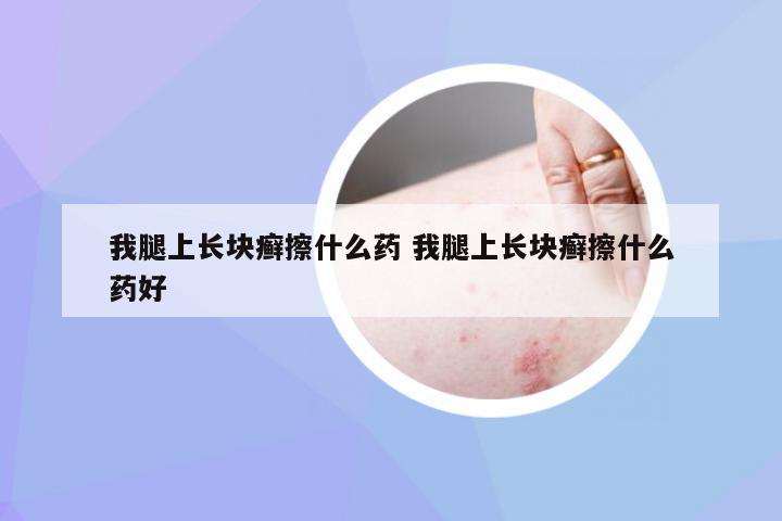 我腿上长块癣擦什么药 我腿上长块癣擦什么药好