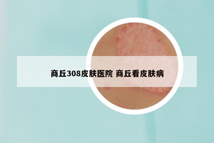 商丘308皮肤医院 商丘看皮肤病