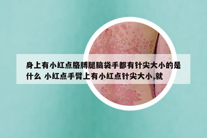 身上有小红点胳膊腿脑袋手都有针尖大小的是什么 小红点手臂上有小红点针尖大小,就