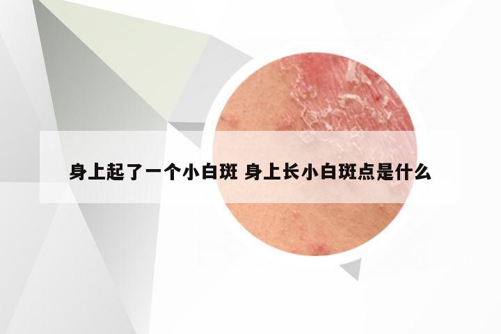 身上起了一个小白斑 身上长小白斑点是什么