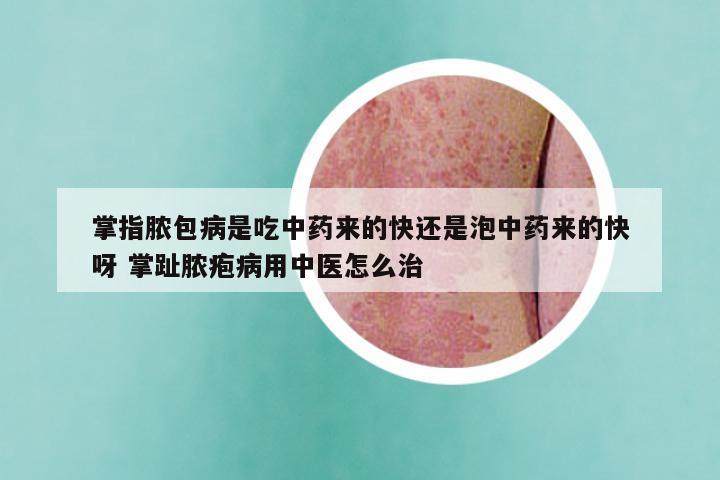 掌指脓包病是吃中药来的快还是泡中药来的快呀 掌趾脓疱病用中医怎么治