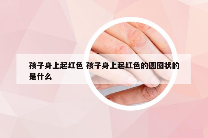 孩子身上起红色 孩子身上起红色的圆圈状的是什么