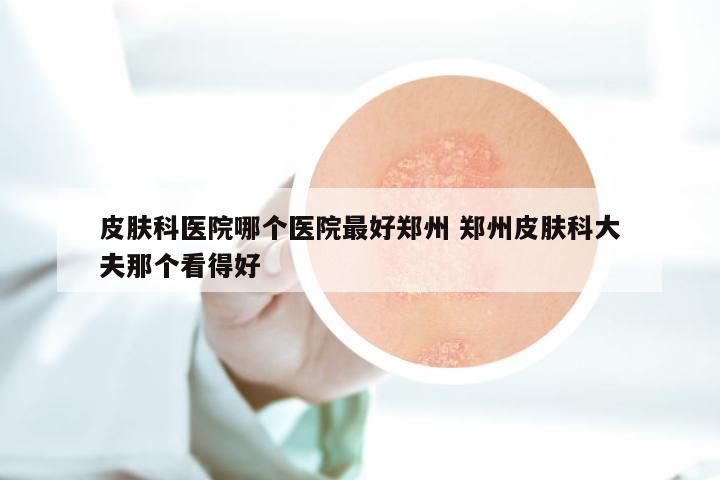 皮肤科医院哪个医院最好郑州 郑州皮肤科大夫那个看得好