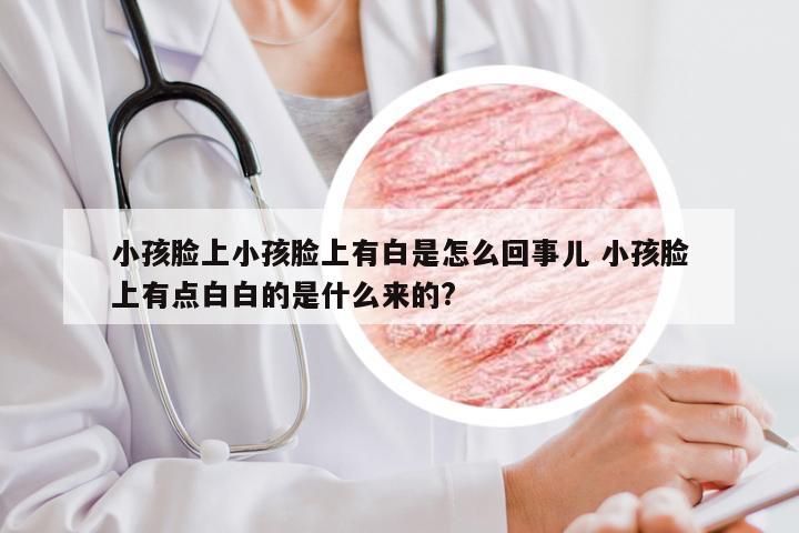 小孩脸上小孩脸上有白是怎么回事儿 小孩脸上有点白白的是什么来的?