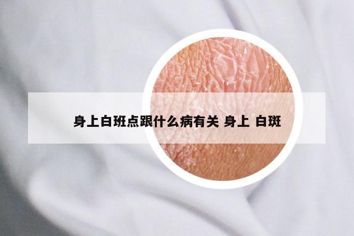 身上白班点跟什么病有关 身上 白斑