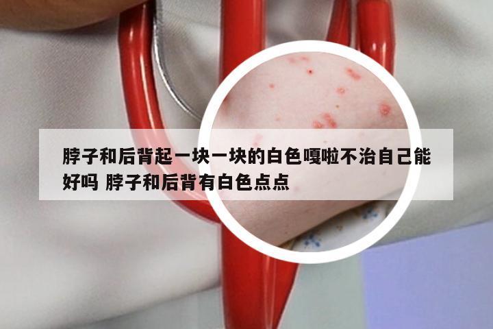 脖子和后背起一块一块的白色嘎啦不治自己能好吗 脖子和后背有白色点点