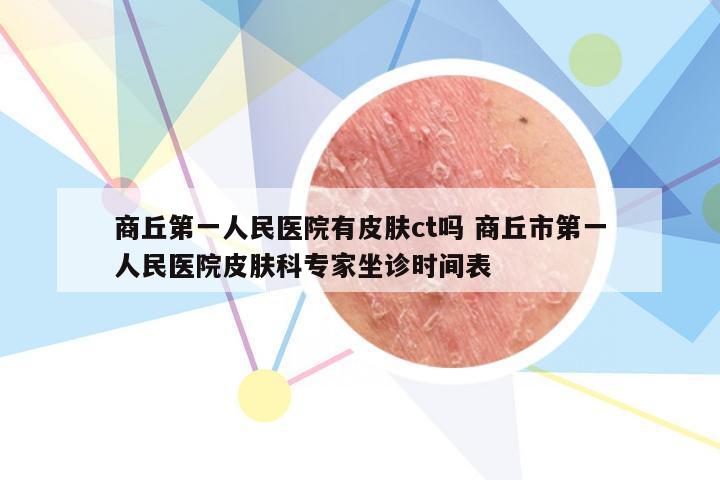 商丘第一人民医院有皮肤ct吗 商丘市第一人民医院皮肤科专家坐诊时间表