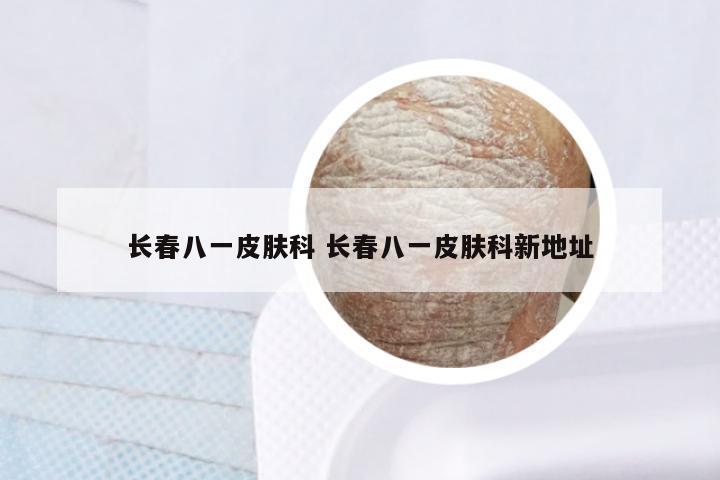 长春八一皮肤科 长春八一皮肤科新地址