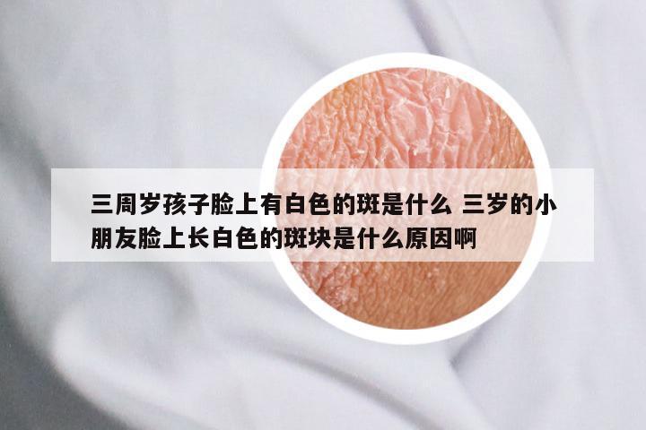 三周岁孩子脸上有白色的斑是什么 三岁的小朋友脸上长白色的斑块是什么原因啊