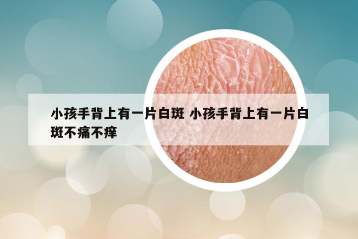 小孩手背上有一片白斑 小孩手背上有一片白斑不痛不痒