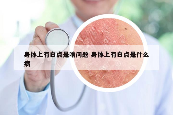 身体上有白点是啥问题 身体上有白点是什么病