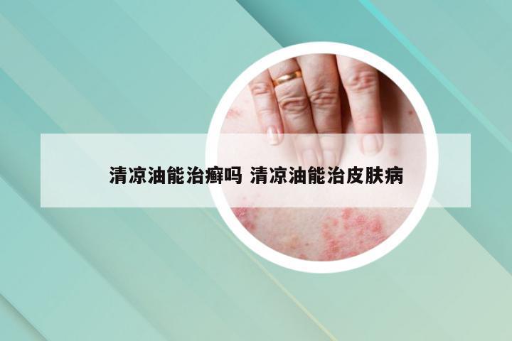 清凉油能治癣吗 清凉油能治皮肤病