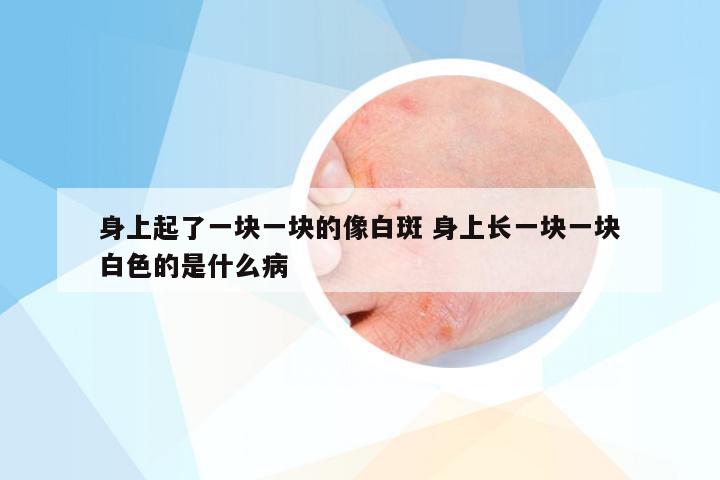 身上起了一块一块的像白斑 身上长一块一块白色的是什么病