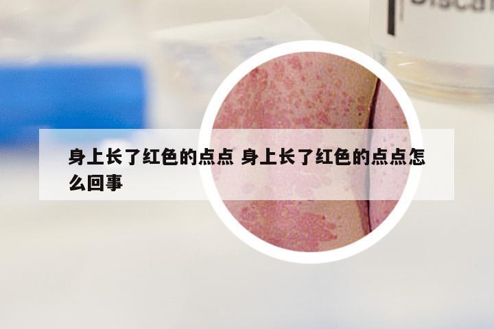 身上长了红色的点点 身上长了红色的点点怎么回事