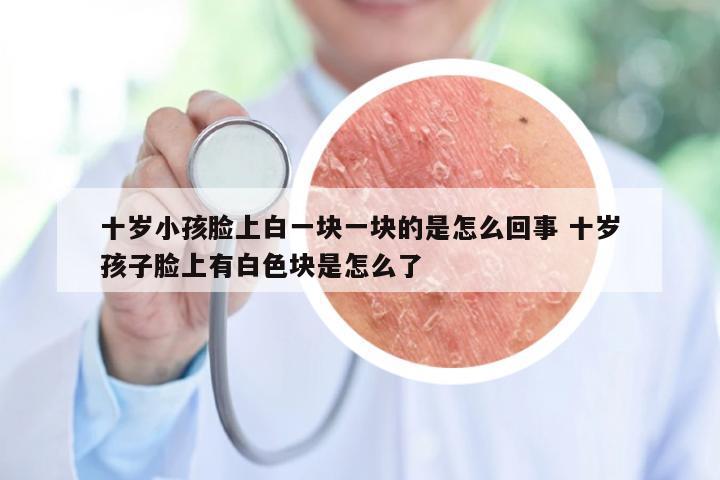 十岁小孩脸上白一块一块的是怎么回事 十岁孩子脸上有白色块是怎么了