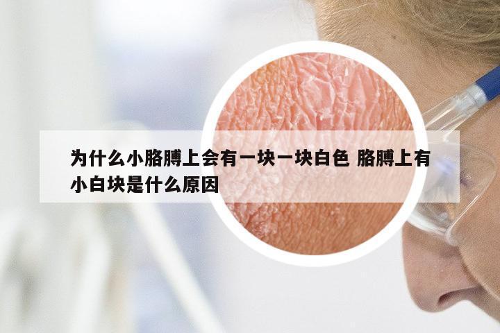 为什么小胳膊上会有一块一块白色 胳膊上有小白块是什么原因