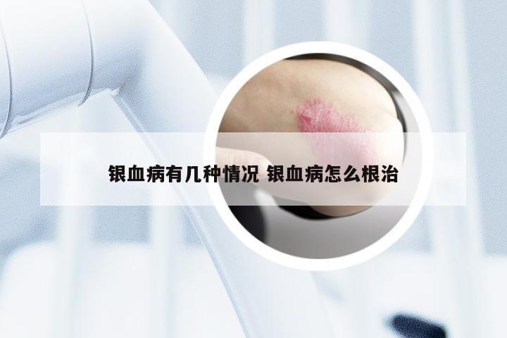 银血病有几种情况 银血病怎么根治