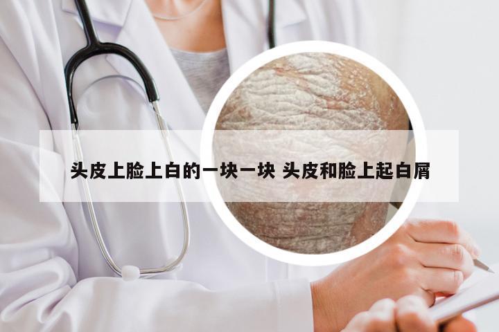 头皮上脸上白的一块一块 头皮和脸上起白屑