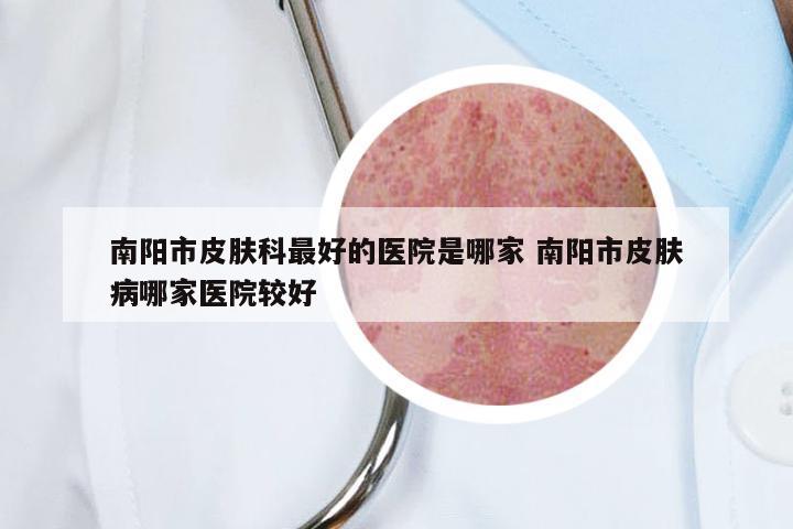 南阳市皮肤科最好的医院是哪家 南阳市皮肤病哪家医院较好
