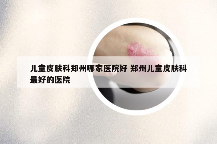儿童皮肤科郑州哪家医院好 郑州儿童皮肤科最好的医院